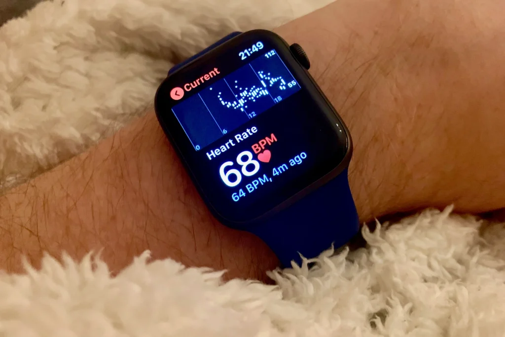 which smartwatch has the best ecg